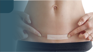 Cuidado de cicatrices